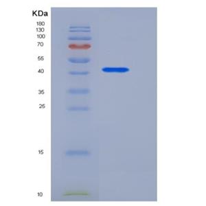 Recombinant Human DDR2 Kinase / CD167b Protein (Fc tag),Recombinant Human DDR2 Kinase / CD167b Protein (Fc tag)