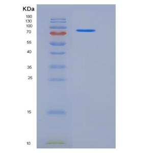 Recombinant Mouse ALCAM / CD166 Protein (His & Fc tag),Recombinant Mouse ALCAM / CD166 Protein (His & Fc tag)