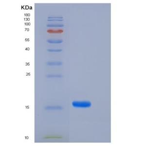 Recombinant Human FABP4 / ALBP / A-FABP Protein (29 Ala/Thr, His tag)