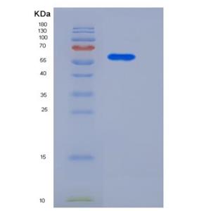 Recombinant Human CD146 / MCAM Protein (His tag),Recombinant Human CD146 / MCAM Protein (His tag)