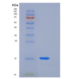 Recombinant Human LAIR2 / CD306 Protein,Recombinant Human LAIR2 / CD306 Protein
