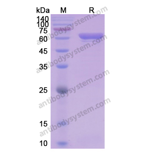 重組HSPD1蛋白,Recombinant Human HSPD1, N-His