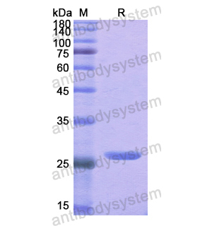 重組THRB蛋白,Recombinant Human THRB, N-His