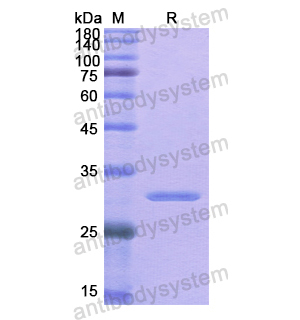 重组GHR蛋白,Recombinant Human GHR, N-His