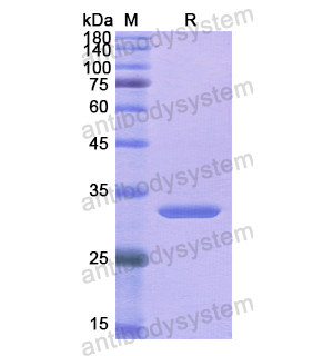 重組IRF1蛋白,Recombinant Human IRF1, N-His