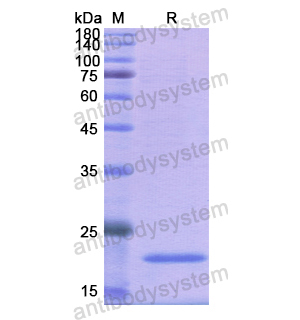 重組MYL2蛋白,Recombinant Human MYL2, N-His