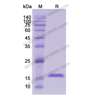 重組CD8B蛋白,Recombinant Human CD8B, N-His