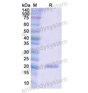 重組MYH3蛋白,Recombinant Human MYH3, N-His