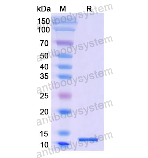 重组SLC2A1蛋白,Recombinant Human SLC2A1, N-His