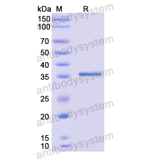 重组SLC2A3蛋白,Recombinant Human SLC2A3, N-GST