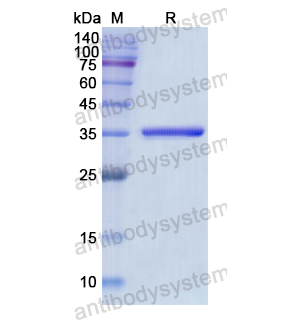 重组EPB41蛋白,Recombinant Human EPB41, N-His