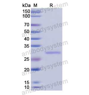 重组PYGB蛋白,Recombinant Human PYGB, N-His