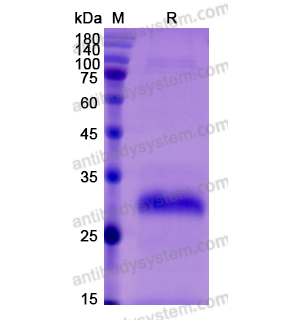 重组MBL2/MBP-C蛋白,Recombinant Mouse MBL2/MBP-C, C-His