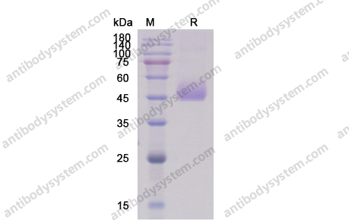 重组CD331/FGFR1蛋白,Recombinant Human CD331/FGFR1, C-His