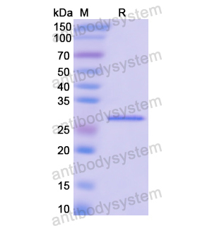 重組TOP2A蛋白,Recombinant Human TOP2A, N-His