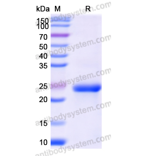 重組CYP19A1蛋白,Recombinant Human CYP19A1, N-His