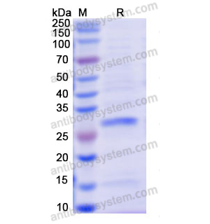 重组DMD蛋白,Recombinant Human DMD, N-His