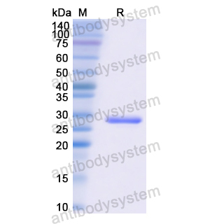 重组CETP蛋白,Recombinant Human CETP, N-His