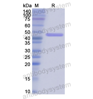 重组SFTPC蛋白,Recombinant Human SFTPC, N-GST