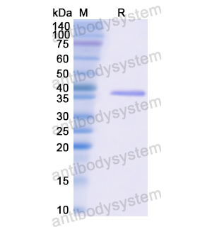 重组CDK4蛋白,Recombinant Human CDK4, N-His