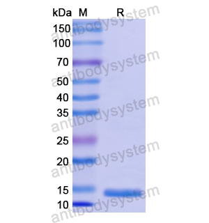 重组CD179a/VPREB1蛋白,Recombinant Human CD179a/VPREB1, N-His