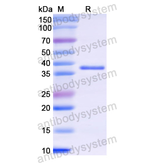 重组KRT3蛋白,Recombinant Human KRT3, N-His