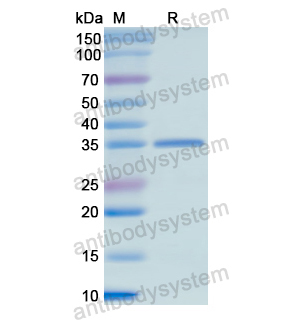 重组HARS1蛋白,Recombinant Human HARS1, N-His