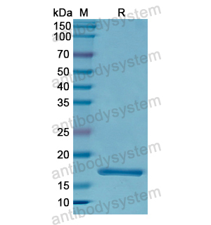 重组FABP2蛋白,Recombinant Human FABP2, N-His