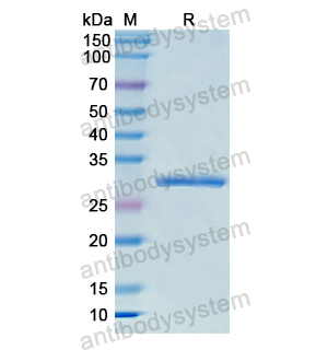 重组COL11A1蛋白,Recombinant Human COL11A1, N-His