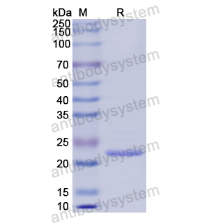 重组COL6A3蛋白,Recombinant Human COL6A3, N-His