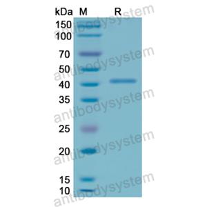 重组CD107a/LAMP1蛋白,Recombinant Human CD107a/LAMP1, N-His