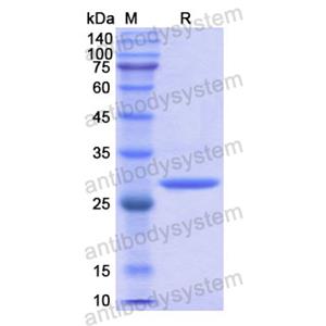 重组PIM1蛋白,Recombinant Human PIM1, N-His