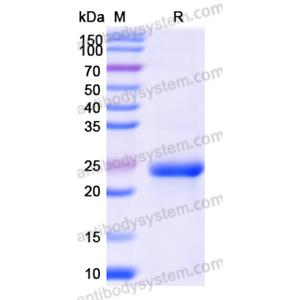 Recombinant Human CYP19A1, N-His