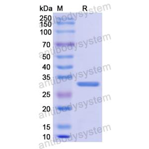 Recombinant Human ODC1, N-His