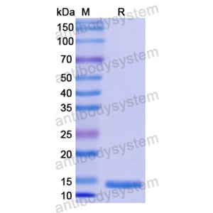 重组CD179a/VPREB1蛋白,Recombinant Human CD179a/VPREB1, N-His