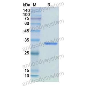 Recombinant Human IMPDH2, N-His