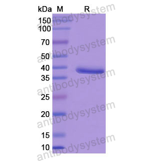 重组RLBP1蛋白,Recombinant Human RLBP1, N-His