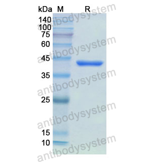 重組CKB蛋白,Recombinant Human CKB, N-His