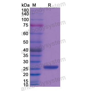 重组CKMT1A蛋白,Recombinant Human CKMT1A, N-His