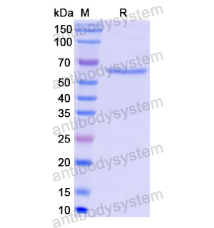 重组CD143/ACE蛋白,Recombinant Human CD143/ACE, N-GST