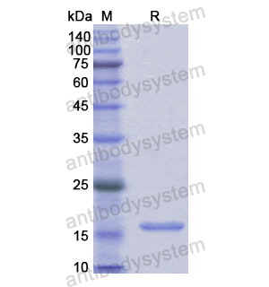 重組MYH1蛋白,Recombinant Human MYH1, N-His