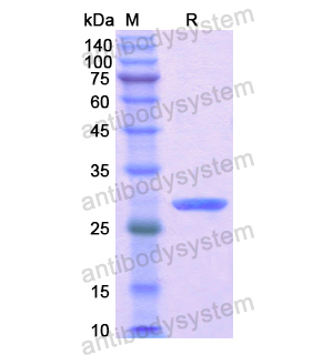 重組MYH7蛋白,Recombinant Human MYH7, N-His