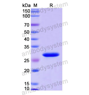 重組UNG蛋白,Recombinant Human UNG, N-His