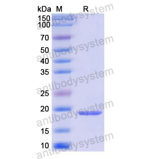 重组IL7蛋白,Recombinant Human IL7, C-His