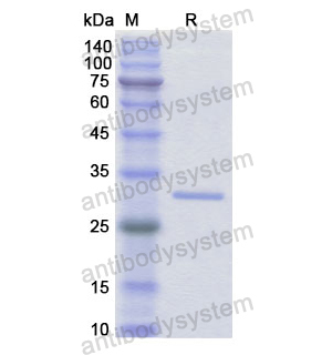 重組IFI30蛋白,Recombinant Human IFI30, N-His