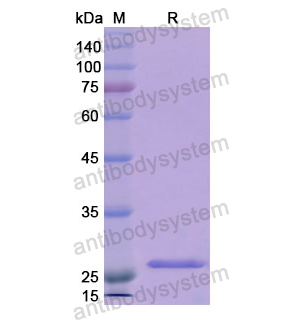 重組RNH1蛋白,Recombinant Human RNH1, N-His