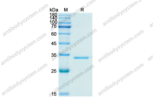 重组CCL5/RANTES蛋白,Recombinant Human CCL5/RANTES, N-GST