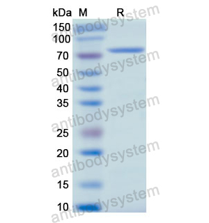 重组SCG2蛋白,Recombinant Human SCG2, N-His