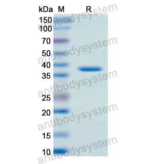 重組CD56/NCAM1蛋白,Recombinant Human CD56/NCAM1, N-His