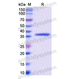 重組KRT10蛋白,Recombinant Human KRT10, N-His